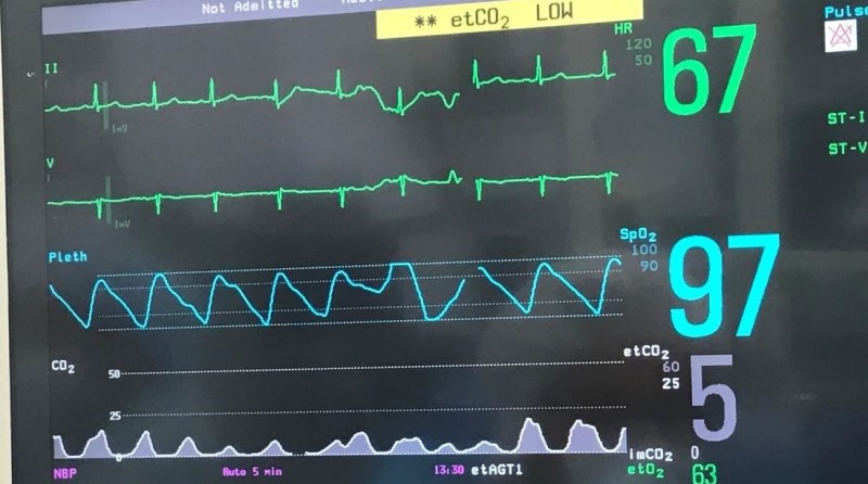 What is capnography used for
